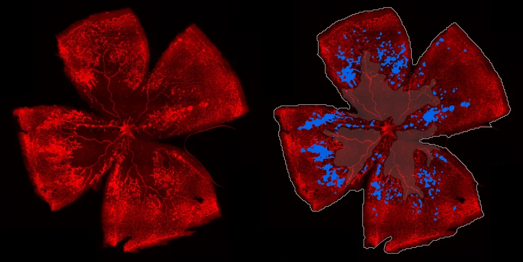 ARVO 2025 presentation: Phosphate-buffered saline administered intravitreally at P12 blocks neovascularization in the mouse oxygen-induced retinopathy model