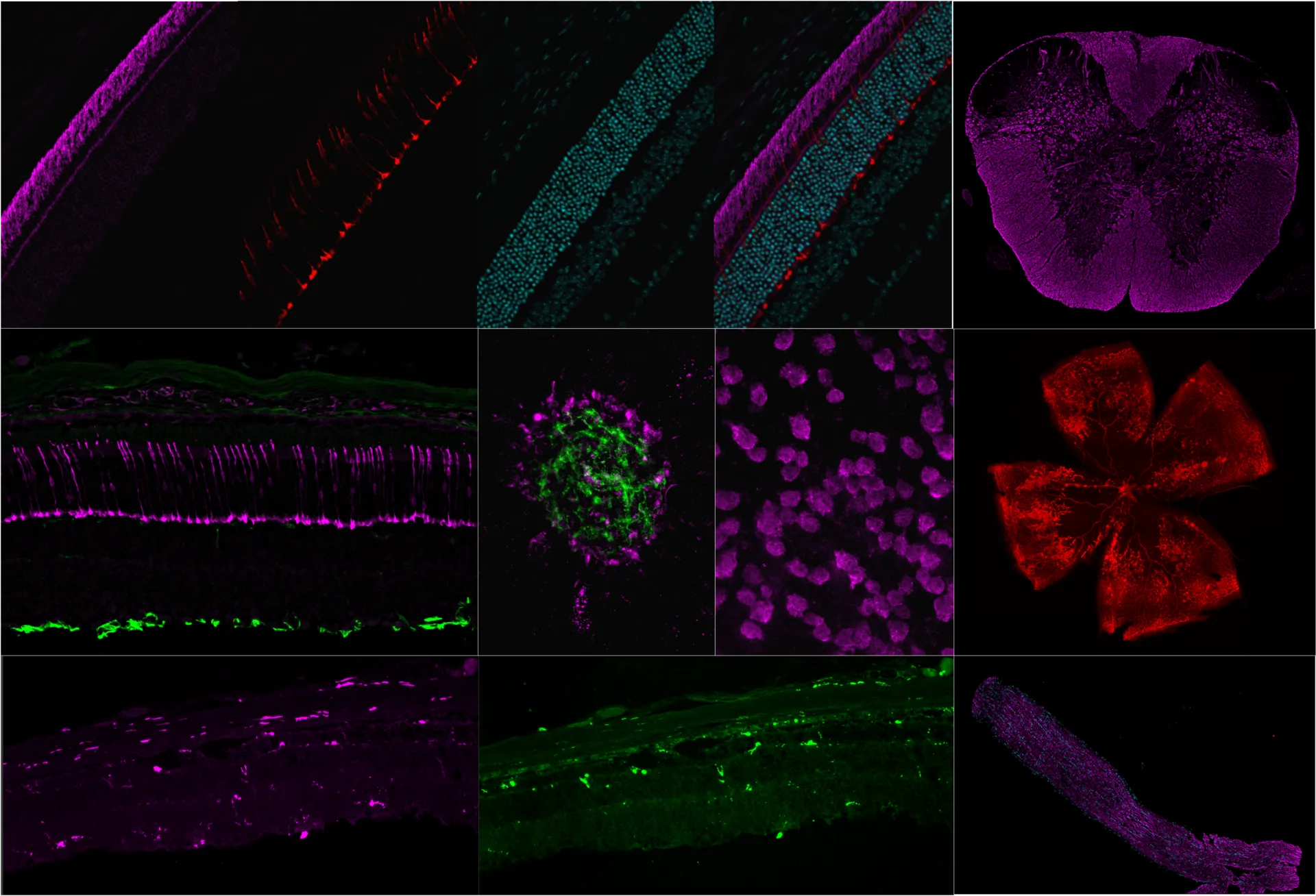 Immunohistochemistry