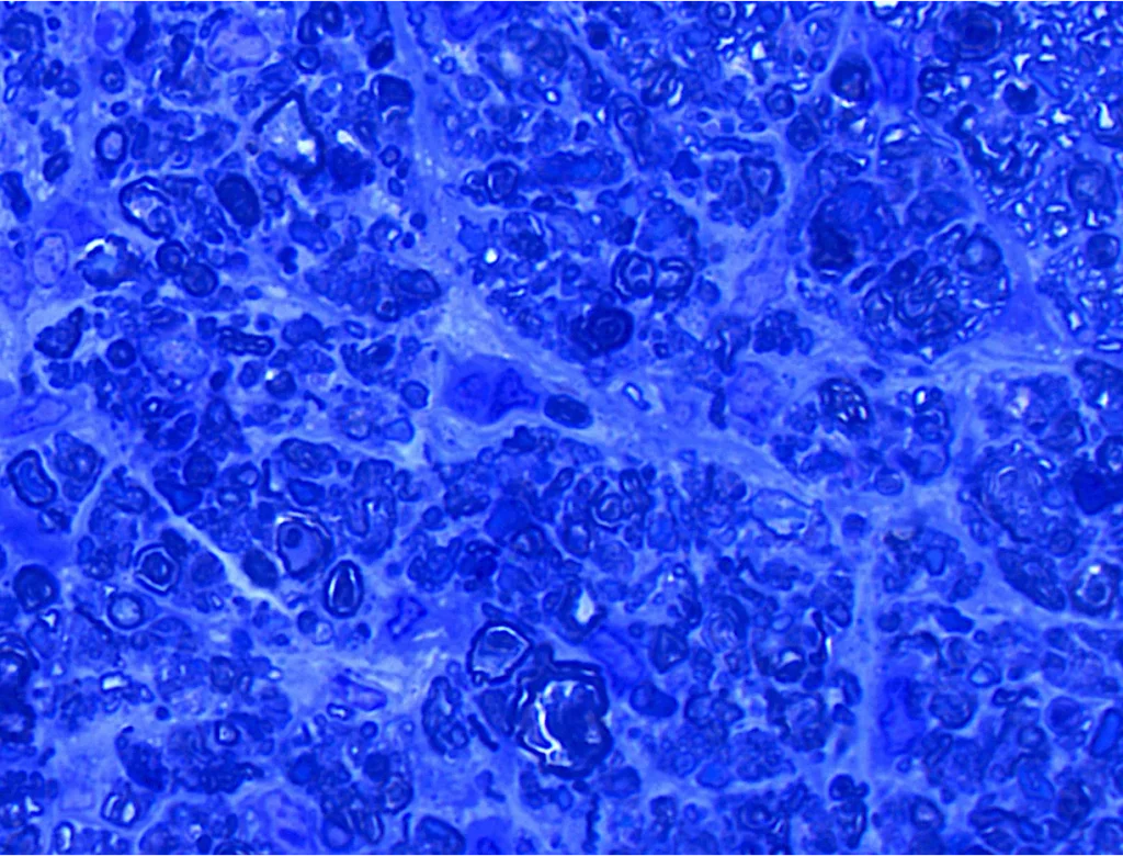 Comprehensive characterization of the rat magnetic microbead model