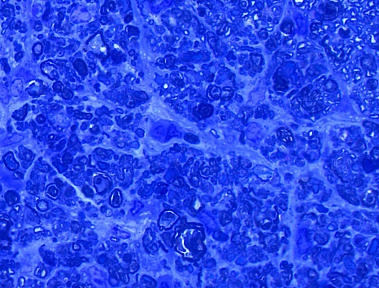 Comprehensive characterization of the rat magnetic microbead model