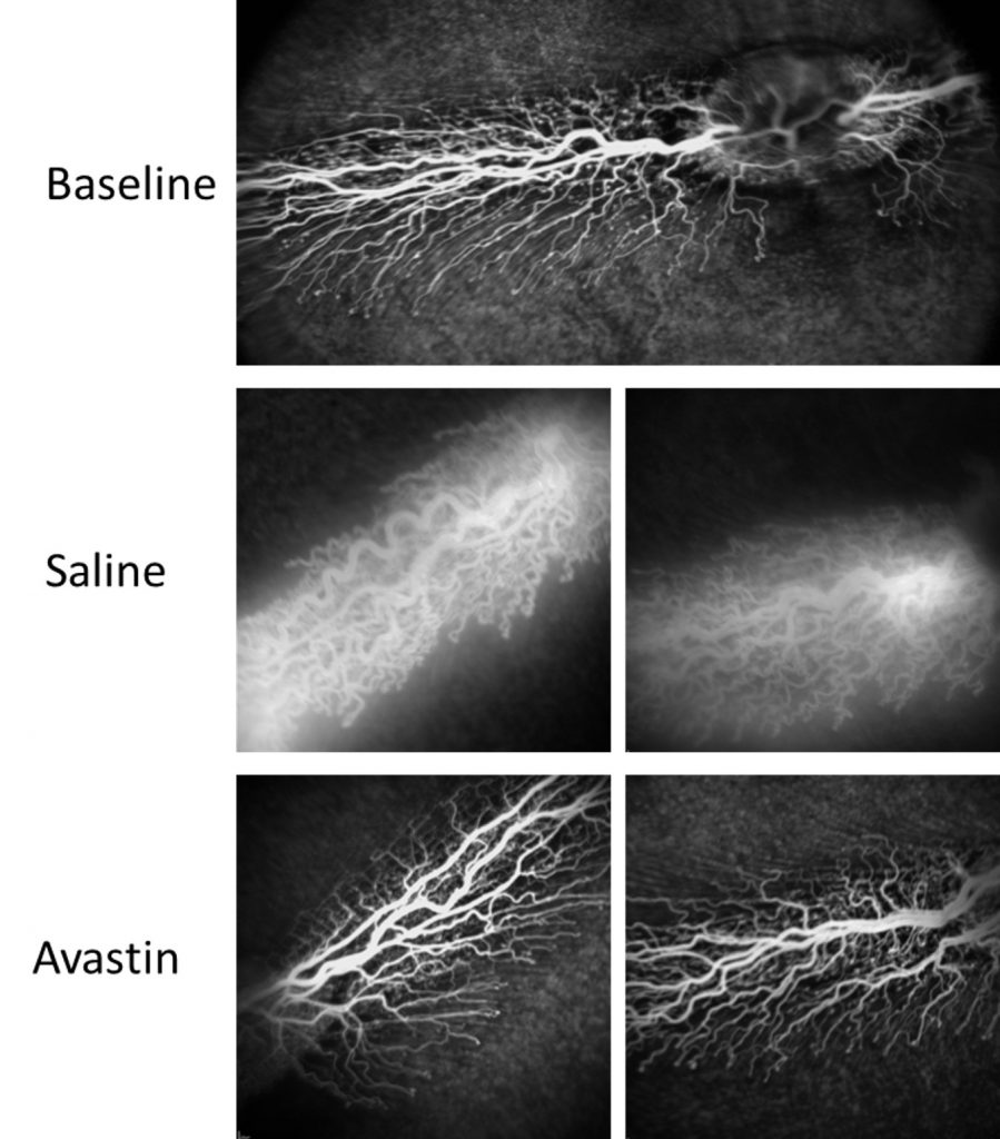 Fig. 1. High-resolution imaging using fluorescein angiography (FA).
