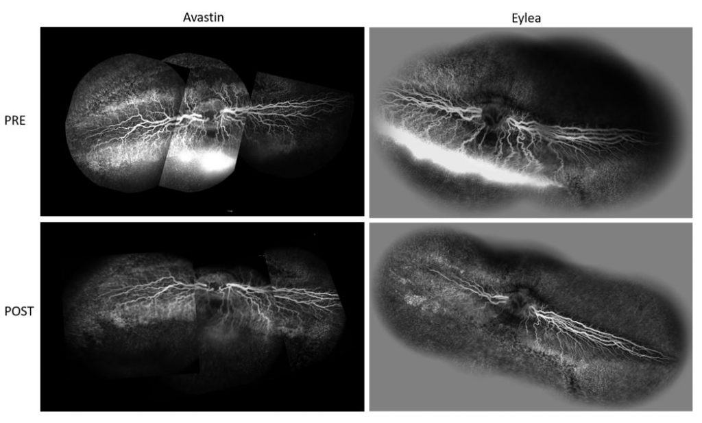 Fig. 1. High-resolution imaging using fluorescein angiography (FA). FA images from DL-2aminoadipic acid (DL-AAA) chronic retinal leakage rabbits are shown.
