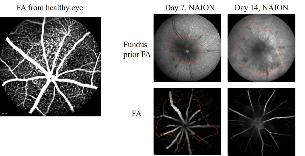 Fig. 1. Fundus and fluorescein angiography (FA) imaging of the mouse NAION model.