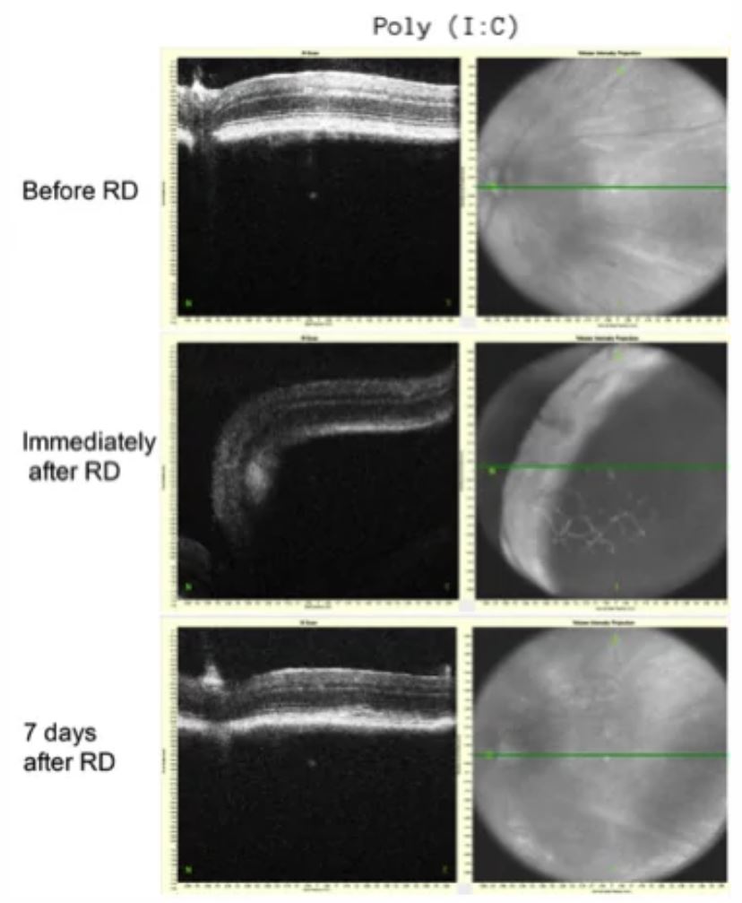Fig. 1. Micrographs taken using SD-OCT at the level of optic nerve head (green line) before RD, immediately after RD and 7 days after RD.