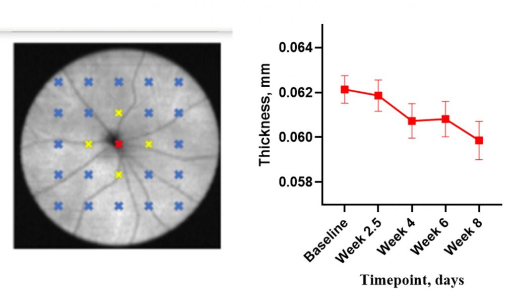 Fig. 1. A representative example of the mouse inner retinal thickness from mild hyperglycemia (mean as assessed from in vivo imaging (SD-OCT). 