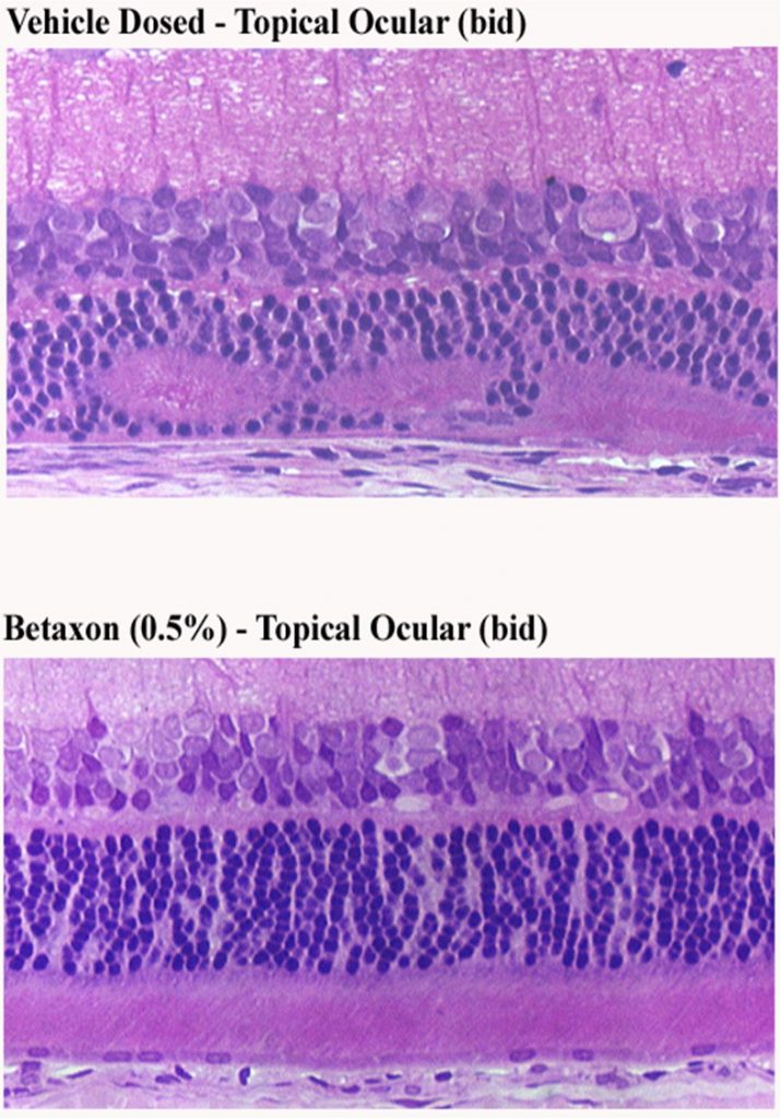 Fig. 3. Retinal Histology sections of Blue light damage (BLD) rat model following 0.5% Betaxon topical ocular treatment.
