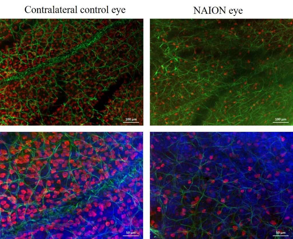 Fig. 4. Retinal flatmounts from mice are immunostained with RGC-specific RBPMS (in red) and an astrocyte specific GFAP (in green). 
