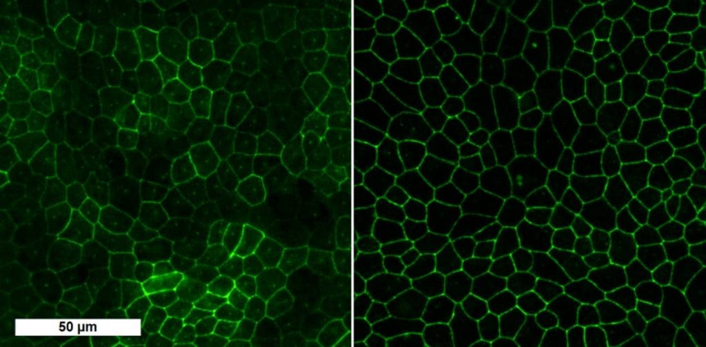 Fig. 1. Expression of tight junction proteins occludin (left) and ZO-1 (right) in human induced pluripotent stem cells (PCi-RPE1426) cultured on Transwell® cell culture inserts (28 days) detected by immunofluorescence staining (green). Scale bar 50 µm. 