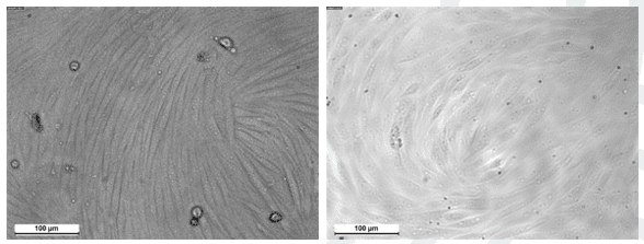 Fig. 1. Typical endothelial cell morphology of BRECs at DIV6 (left) and DIV7 (right).