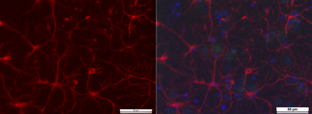 Fig. 1. Immunostaining of the rat primary cortical neurons (in red) counterstained with cellular nuclear marker DAPI (in blue). 