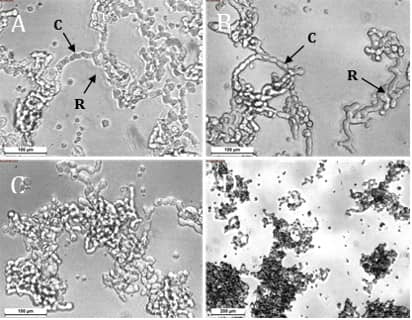 Fig. 1. A, B) Typical morphology of WERI-Rb-1 cells showing rosettes (R) and chain (C) formation. 