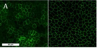 Fig. 1. Expression and localization of tight junction proteins, occludin (left panel), zonula occludens 1 (ZO-1, right panel) in novel RPE cells derived from human induced pluripotent stem cells (PCi-RPE1426). Scale bar 50 µm. 