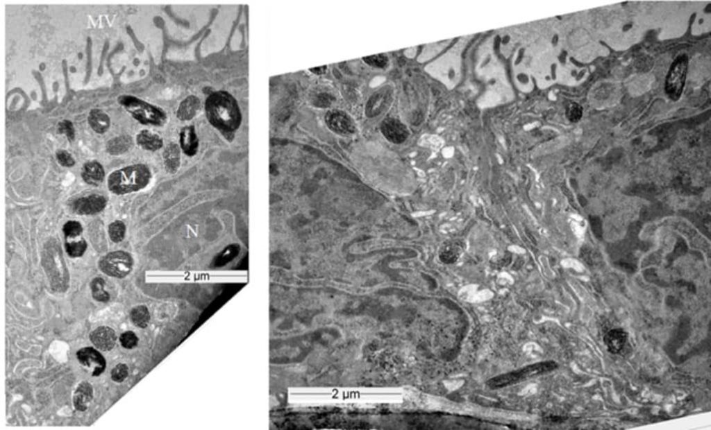 Fig. 2. : Transmission electron microscopy images of vertical cross sections of RPE cells showing the intracellular cell organelles, MV, microvilli; M, melanosome; N, nucleus.