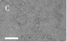 Fig. 3. : Novel RPE cells (PCi-RPE1426). Scale bar 100 µm. 